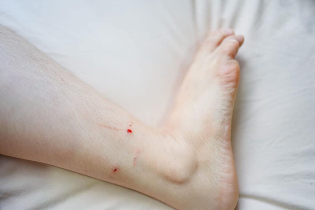 Ouch! The Mystery of Cat Bites & How to Prevent Them