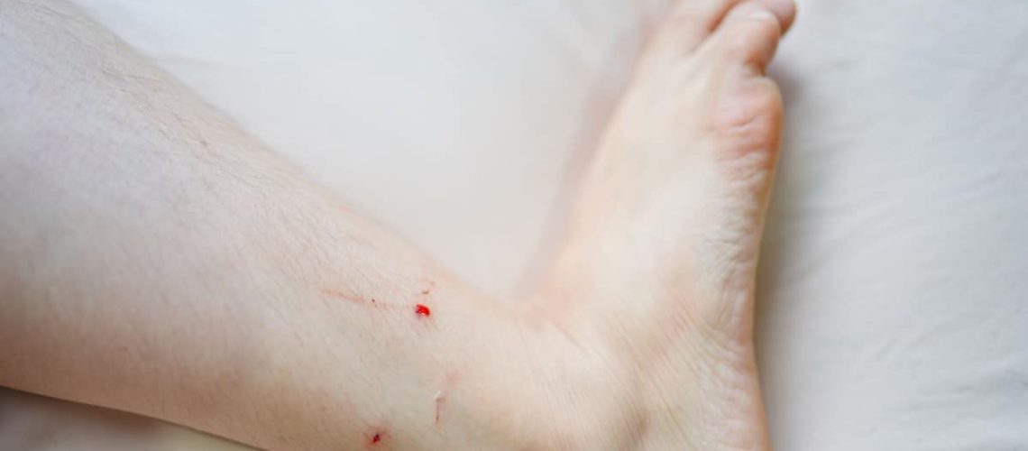 Ouch! The Mystery of Cat Bites & How to Prevent Them