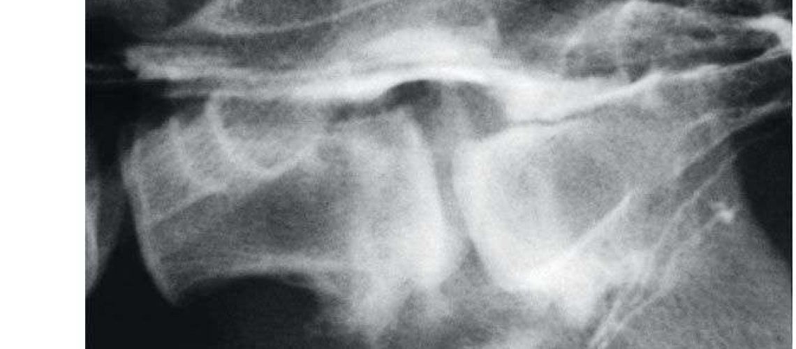 Spinal Stenosis in Dogs-WildCreaturey